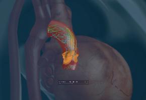 Le projet de coeur virtuel "iHeart" pourrait aider les cliniciens à gérer des questions importantes. EPFL