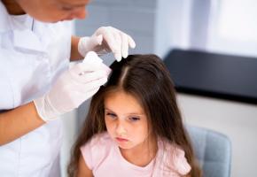 Difficiles à enlever, les poux n’occasionnent cependant pas de maladies chez les enfants. 123RF Difficiles à enlever, les poux n’occasionnent cependant pas de maladies chez les enfants. 123RF