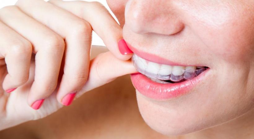 Avoir des dents alignées, c’est aujourd’hui très tendance. dr