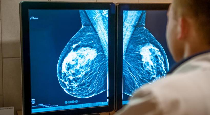 Les clichés sont analysés par deux radiologues indépendants l’un de l’autre. 123RF