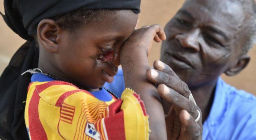 La Fondation Sentinelles est très active en Afrique et vient notamment en aide aux enfants victimes du noma. WULLSCHLEGER