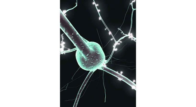 Lausanne, capitale mondiale du cerveau DR